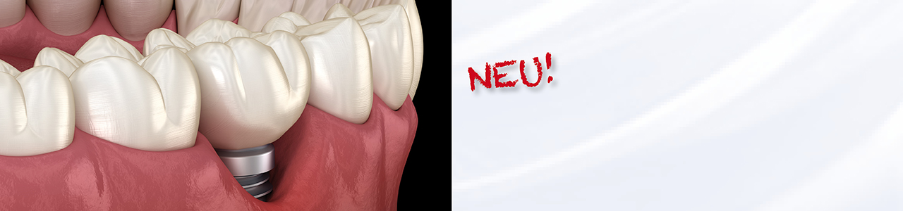 NEU!!! Unser Curriculum Periimplantäre Erkrankungen Startdatum 24./25.02.2023 Jetzt anmelden!